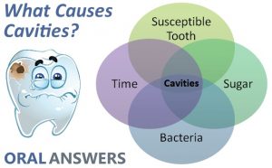 tooth decay