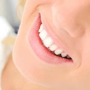 clean-healthy-teeth
