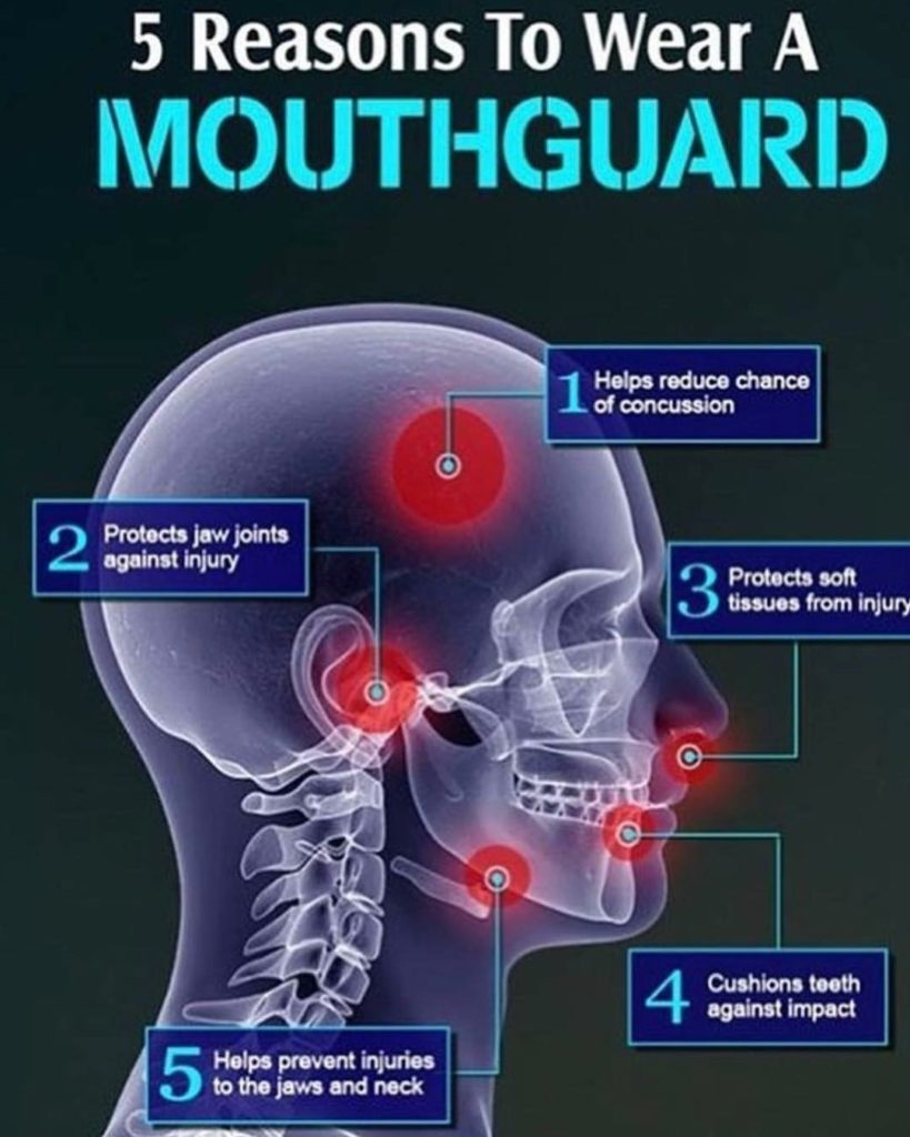 Get a Custom Sports Mouthguard At Embrace Dental HygieneGet Custom